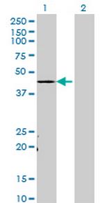 TADA3L Monoclonal Antibody (3H3)