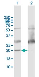 ATP5H Polyclonal Antibody, MaxPab™