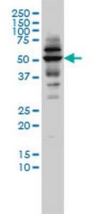 CAP2 Antibody in Western Blot (WB)