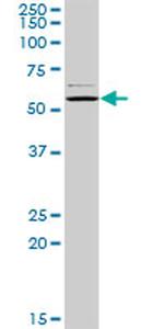 CAP1 Antibody in Western Blot (WB)