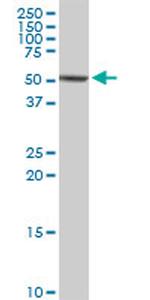 CAP1 Antibody in Western Blot (WB)