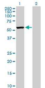CAP1 Antibody in Western Blot (WB)