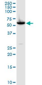CAP1 Antibody in Western Blot (WB)
