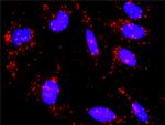 CREB3 Antibody in Proximity Ligation Assay (PLA) (PLA)