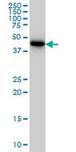 CRTAP Monoclonal Antibody (4D9)