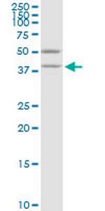 VAT1 Monoclonal Antibody (3E9)