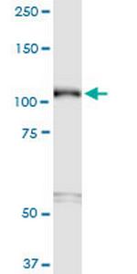 SEMA6B Monoclonal Antibody (2H7)