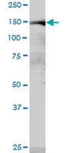 MYBBP1A Polyclonal Antibody, MaxPab™