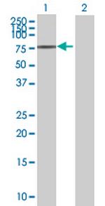 DEAF1 Antibody in Western Blot (WB)