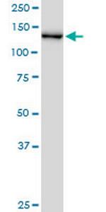 CHERP Antibody in Western Blot (WB)