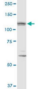IPO8 Monoclonal Antibody (3D5)