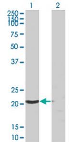 SSSCA1 Monoclonal Antibody (2H4)