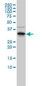 RNASEH2A Monoclonal Antibody (3G5-F5)