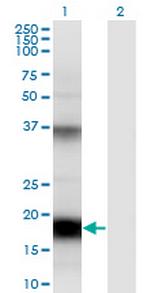 UBD Monoclonal Antibody (7D8)
