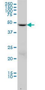 DCTN2 Monoclonal Antibody (2G7)