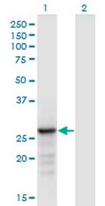 ANP32B Monoclonal Antibody (8E10)