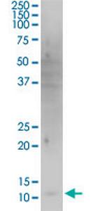 HBXIP Antibody in Western Blot (WB)