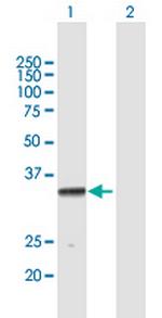 PROCR Polyclonal Antibody, MaxPab™