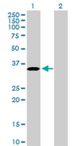 PROCR Antibody in Western Blot (WB)