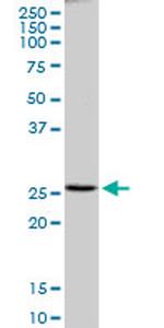 PRDX4 Antibody in Western Blot (WB)