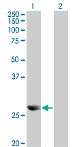 PRDX4 Antibody in Western Blot (WB)