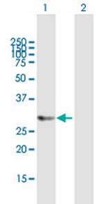 HTATIP2 Polyclonal Antibody, MaxPab™