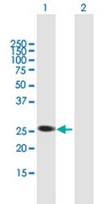 AGPAT1 Polyclonal Antibody, MaxPab™