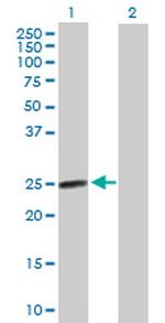 AGPAT2 Antibody in Western Blot (WB)