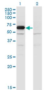 DPYSL4 Monoclonal Antibody (1F5)
