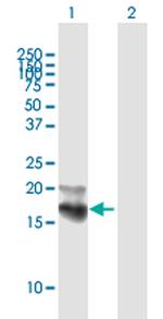 NPC2 Polyclonal Antibody, MaxPab™