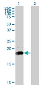 NPC2 Monoclonal Antibody (4B9)