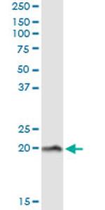 NPC2 Monoclonal Antibody (1F4)