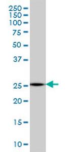 MTHFS Monoclonal Antibody (2C12)