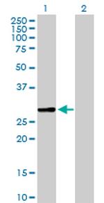 SCGN Antibody in Western Blot (WB)