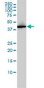 AHSA1 Monoclonal Antibody (1A2-A8)
