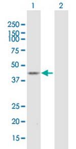ST6GALNAC2 Polyclonal Antibody, MaxPab™