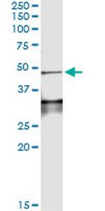 LEFTY1 Monoclonal Antibody (4D7)