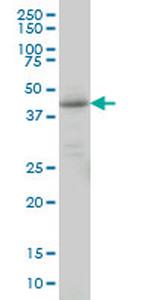 LEFTY1 Monoclonal Antibody (2E10)