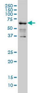 IGF2BP3 Monoclonal Antibody (3B12)