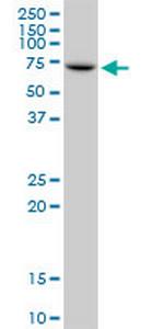 IGF2BP2 Antibody in Western Blot (WB)