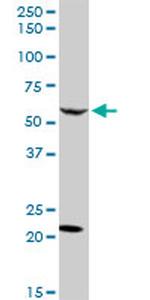 CAMKK2 Antibody in Western Blot (WB)