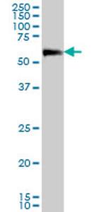 CAMKK2 Antibody in Western Blot (WB)
