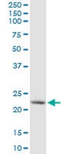 YKT6 Monoclonal Antibody (1F8)