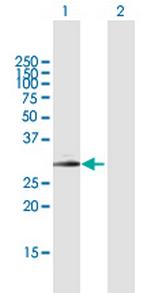 SPINT2 Polyclonal Antibody, MaxPab™