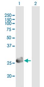 SPINT2 Polyclonal Antibody, MaxPab™