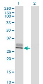 SPINT2 Monoclonal Antibody (2D1)