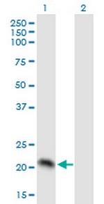PMVK Antibody in Western Blot (WB)