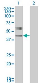 B3GNT2 Monoclonal Antibody (1A8)