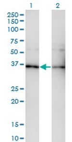GNB5 Monoclonal Antibody (3A3)