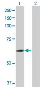 CCT6B Polyclonal Antibody, MaxPab™